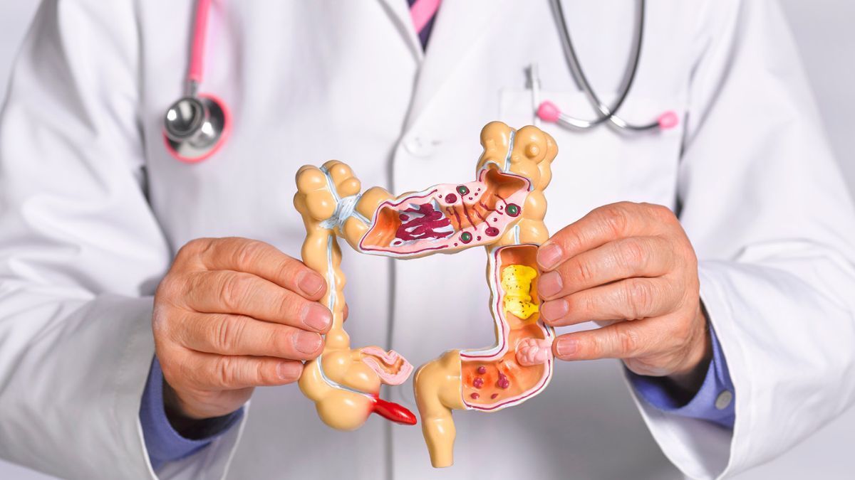 Continúa la campaña de prevención de cáncer de colón